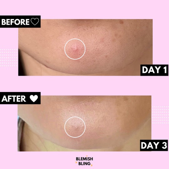 TheOneShu X Baby Shu Patches